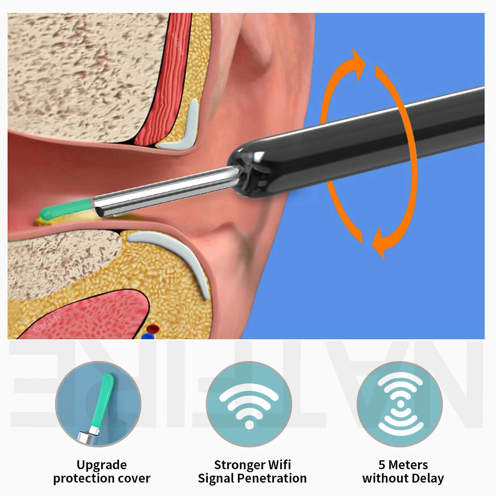 EarScope